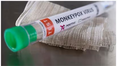 മങ്കിപോക്സ് വൈറസ് വീട്ടുപകരണങ്ങളിൽ ദിവസങ്ങളോളം നിലനിൽക്കാമെന്ന് പഠനം