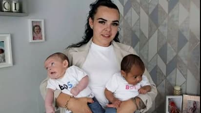 അപൂര്‍വതകളോടെ ഇരട്ട സഹോദരങ്ങള്‍; ഇവരുടെ പ്രത്യേകതയെന്തെന്ന് അറിയാമോ? 