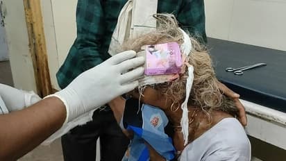 തലയിലെ ബാൻഡേജ് അഴിച്ചപ്പോൾ കണ്ടത് ‘കോണ്ടം പാക്കറ്റ്’; വീഡിയോ കാണാം