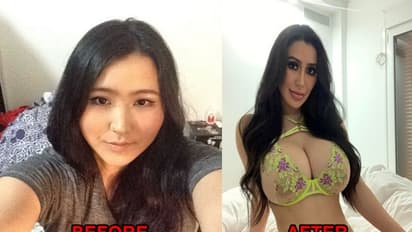 किम कार्दशियन जैसा दिखने के लिए 8 साल में कराई 15 सर्जरी, अब लोग बोलते हैं-तुम वो तो नहीं