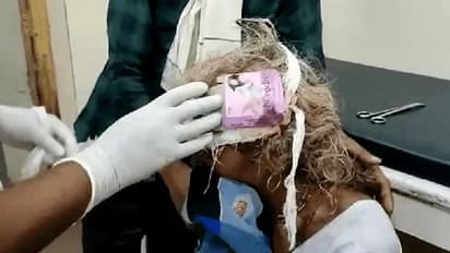 MP का शर्मनाक कांड: इलाज के लिए गई महिला के सिर पर लगाया कंडोम रैपर, होश उड़ा देगी घटना...देखिए वीडियो