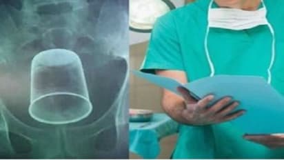 அதிர்ச்சி சம்பவம்..! பார்ட்டியில் நண்பர்களுடன் போதை.. ஆசனவாயில் டம்ளரை சொருகிய நண்பர்கள்