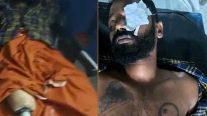 പൊലീസ് മുഖത്തടിച്ചു, മുതുകത്ത് ചുറ്റിക കൊണ്ട് ഇടിച്ചു, വാരിയെല്ല് പൊട്ടി; പരാതിയുമായി ഭിന്നശേഷിക്കാരൻ