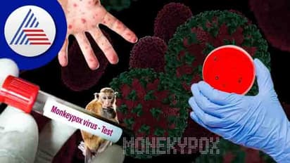 తగ్గని మంకీపాక్స్ కలవరం.. కఠిన చర్యలు తీసుకుంటున్న పలు దేశాలు