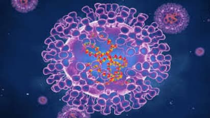 Monkeypox: ലോകത്താദ്യമായി മങ്കിപോക്സും കൊവിഡും എയ്ഡ്സും ഒരേസമയം ഒരാളിൽ സ്ഥിരീകരിച്ചു