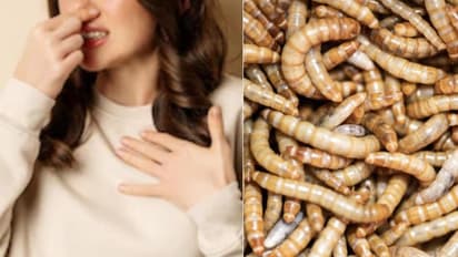 ಮಹಿಳೆಯ ಮೂಗಿನಲ್ಲಿತ್ತು ಭರ್ತಿ 150 ನೊಣ, ವೈದ್ಯರಿಗೇ ಶಾಕ್ !