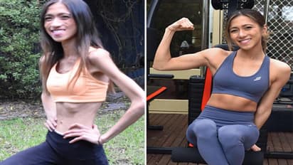 मॉडल बनने के लिए लड़की ने Weight loss का अपनाया ऐसा तरीका, दिखने लगी कंकाल जैसी, ना करें ऐसी भूल