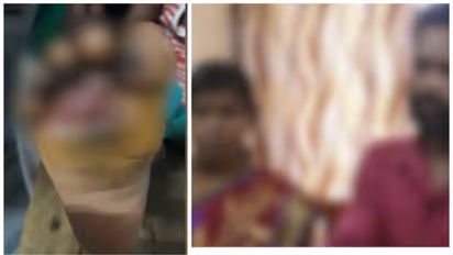 നാല് വയസുകാരന്റെ കാൽ സ്റ്റൌവിൽവെച്ച് പൊള്ളിച്ചു, ക്രൂരമർദ്ദനം; അമ്മയും ആൺസുഹൃത്തും പിടിയിൽ; കുട്ടി ചികിത്സയിൽ
