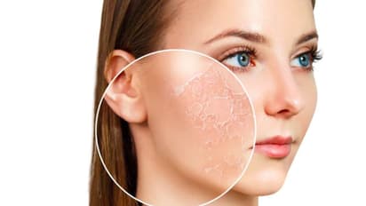 മുഖസൗന്ദര്യത്തിന് ബദാം കൊണ്ടുള്ള ഫേസ് പാക്കുകൾ