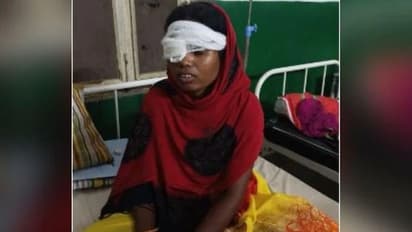 कसाई बना पति...उंगली डालकर निकाली पत्नी की आंख, फिर हंसिये से किए दो टुकड़े, खौफनाक है कहानी