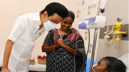 முகச்சிதைவால் பாதிக்கப்பட்டு சிகிச்சை பெறும் சிறுமி...  நேரில் சென்று நலம் விசாரித்த மு.க.ஸ்டாலின்!!