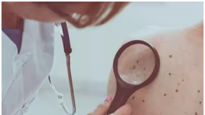 Skin Cancer Symptoms : സ്കിൻ ക്യാൻസർ; ഈ ലക്ഷണങ്ങൾ തള്ളിക്കളയരുത്