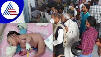 ಕಾಲಿರುವ ಜಾಗದಲ್ಲಿ ಕೊಂಬು: ಮಧ್ಯಪ್ರದೇಶದಲ್ಲಿ ವಿಚಿತ್ರ ಮಗು ಜನನ: ಆಸ್ಪತ್ರೆಯಲ್ಲಿ ಜನವೋ ಜನ