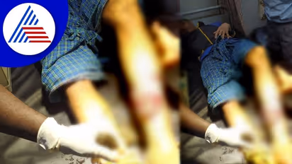 Chikkamagaluru: ತೋಟದಲ್ಲಿ ಕೆಲಸ ಮಾಡುವಾಗ ಕಾರ್ಮಿಕನ ಮೇಲೆ ಕರಡಿ ದಾಳಿ: ಗಂಭೀರ ಗಾಯ