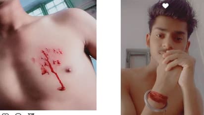 स्कूल की प्रार्थना सभा में घटी अजीब घटना, छात्र ने फोटो शेयर कर लिखा- दर्द बहुत था थोड़ा खून निकाल दिया