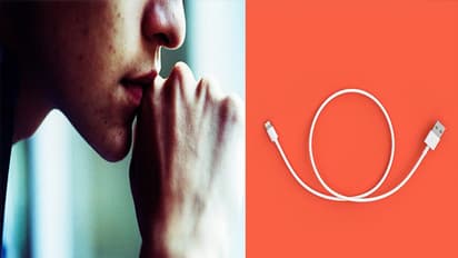 15 साल के लड़के के प्राइवेट पार्ट में अटका USB केबल, हालत देख डॉक्टर भी हैरान, तस्वीर देख हिल जाएंगे