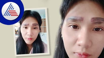 ಇವಳಿಗೆ ಎರಡಲ್ಲ, 4 ಹುಬ್ಬು ! ಕಾಸ್ಮೆಟಿಕ್ ಸರ್ಜರಿಯಿಂದಾಯ್ತು ಎಡವಟ್ಟು