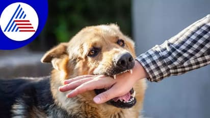 ನಾಯಿ ಕಚ್ಚಿದಾಗ ತಕ್ಷಣ ಕ್ರಮ ತಗೊಳ್ಳಿ, ಇಲ್ಲಾಂದ್ರೆ ರೇಬೀಸ್ ಬರೋದು ಗ್ಯಾರಂಟಿ !