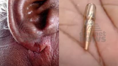 ഫോര്‍ട്ട്കൊച്ചിയില്‍ മത്സ്യത്തൊഴിലാളിക്ക് കടലില്‍വെച്ച് വെടിയേറ്റു