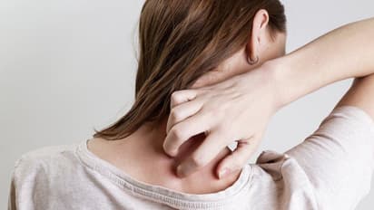 വൃക്കതകരാർ ; ചർമ്മത്തിൽ പ്രകടമാകുന്ന ലക്ഷണങ്ങൾ  