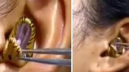 Viral Video: ಮಹಿಳೆಯ ಕಿವಿಯಲ್ಲಿ ಸಿಕ್ಕಿಹಾಕಿಕೊಂಡ ಹಾವು: ಹೊರತೆಗೆಯೋಕೆ ವೈದ್ಯರ ಪ್ರಯತ್ನ ಹೇಗಿದೆ ನೋಡಿ..!