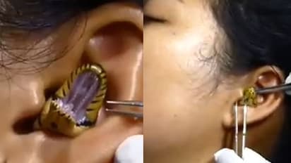 பெண்ணின் காதுக்குள் புகுந்த பாம்பு... அடுத்து நிகழ்ந்தது என்ன? அதிர்ச்சியை ஏற்படுத்தும் வீடியோ!!