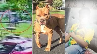 அச்சச்சோ.!  முகத்தில் 200 தையல்கள்.. 11 வயது சிறுவனை ஆக்ரோசமாக கடித்த பிட்புல் நாய் - அதிர்ச்சி வீடியோ !