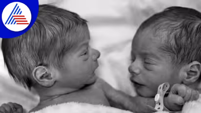 ಅರೆ, ಇದ್ಹೇಗ್ ಸಾಧ್ಯ ! ಯುವತಿ ಜನ್ಮ ನೀಡಿದ ಅವಳಿ ಮಕ್ಕಳ ತಂದೆ ಒಬ್ಬರೇ ಅಲ್ಲ..!