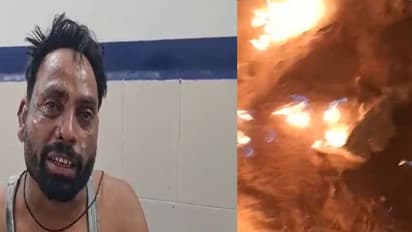 युवक को जिंदा जलाकर मारने की कोशिश, दो लोगों के विवाद का कर रहा था निपटारा