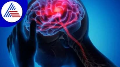 ಹೆಚ್ಚು ಉಪ್ಪು ತಿನ್ನೋ ಅಭ್ಯಾಸದಿಂದ ಕಾಡುತ್ತೆ ಬ್ರೈನ್ ಸ್ಟ್ರೋಕ್