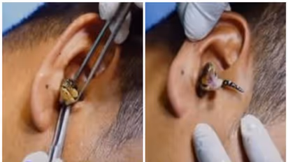 Viral Video:  യുവതിയുടെ ചെവിയില്‍ പാമ്പ് ; വീഡിയോയ്ക്ക് പിന്നിലെ സത്യാവസ്ഥ ഇതാണ്