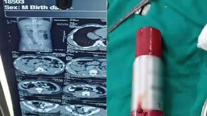 பின்புறத்தில் செண்ட் பாட்டிலை சொருகிய நபர்… இயற்கை உபாதை கழிக்க முடியாமல் தவிப்பு… அடுத்து நடந்தது என்ன?