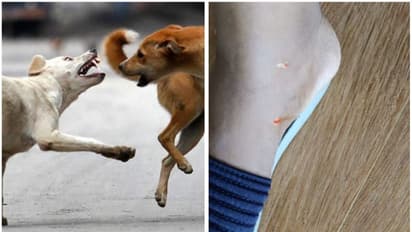 വിദ്യാർത്ഥിക്ക് തെരുവുനായയുടെ കടിയേറ്റു, ആക്രമിച്ചത് സ്കൂളിലേക്ക് പോകുന്നവഴിയിൽവെച്ച്