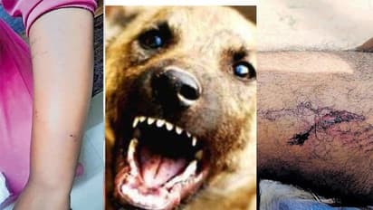 തെരുവ് നായകൾക്ക് ഭക്ഷണം നൽകുന്നതിനിടെ സീരിയൽ നടിക്ക് കടിയേറ്റു