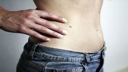 உடலில் திடீர்.... திடீர்...ன்னு மச்சம் வருதா? அலட்சியம் வேண்டாம்...இந்த பாதிப்பாகவும் இருக்கலாம்..!!