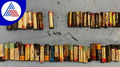 ಅಬ್ಬಬ್ಬಾ..ಮಹಿಳೆ ನುಂಗಿದ್ದು ಬರೋಬ್ಬರಿ  55 ಬ್ಯಾಟರಿ, ಆಪರೇಷನ್ ಮಾಡಿದ ವೈದ್ಯರೇ ಸುಸ್ತು !