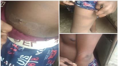 ശ്രീചിത്ര പുവർ ഹോമിൽ 14കാരന് ക്രൂരമർദ്ദനം; സഹപാഠികളായ അഞ്ച് കുട്ടികള്‍ ചേർന്ന് മർദ്ദിച്ചെന്ന് പരാതി 