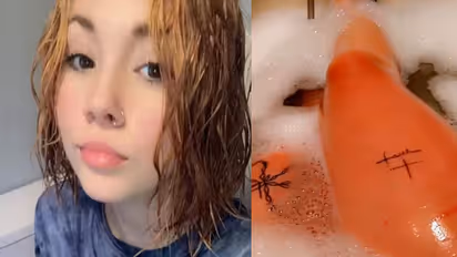 14 साल की इस लड़की को है पानी से एलर्जी, नहाना तो दूर आंसू और पसीना बहाना भी है मना