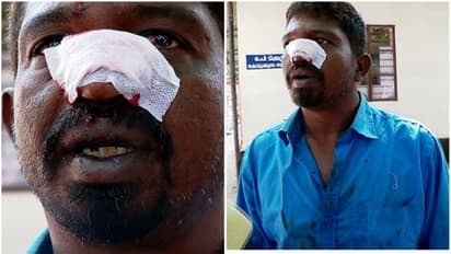 'വലിയ ക്രൂരതയാണ് സാറേ അവര് കാണിക്കുന്നത്', നിർത്തിയിട്ട ലോറിക്ക് നേരെ കല്ലേറ്, ഡ്രൈവറുടെ കണ്ണിൽ ചില്ല് കേറി