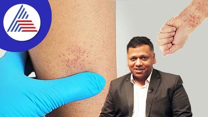 ಗಾಯವಾಗುವಾಗ ವಿಪರೀತ ರಕ್ತಸ್ತ್ರಾವವಾಗುತ್ತಾ ? ಎಚ್ಚರ..ಇದು ಕೂಡಾ ಒಂದು ಕಾಯಿಲೆ !