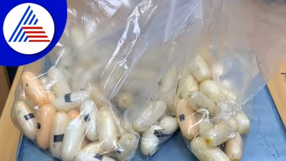 ಡ್ರಗ್ ಪೆಡ್ಲರ್ ಹೊಟ್ಟೆಯಲ್ಲಿತ್ತು 13.6 ಕೋಟಿ ರೂ. ಮೌಲ್ಯದ 104 ಕೊಕೇನ್ ಕ್ಯಾಪ್ಸುಲ್!