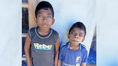 കണ്ണുകളിൽ ഇരുൾ മൂടുന്ന രോഗാവസ്ഥ; മുകോപോളിസാക്കി റിഡോസിസിൽ ചികിത്സാ സഹായം തേടി കുഞ്ഞു സഹോദരങ്ങൾ