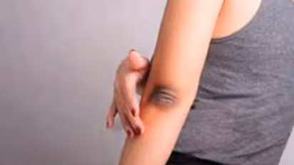 Skin Care: കൈമുട്ടിലെ കറുപ്പ് നിറം മാറാന്‍ പരീക്ഷിക്കാം ഈ ഒമ്പത് കാര്യങ്ങള്‍...