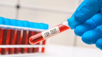 Can blood tests help in indicating a heart attack? Can it determine heart problems? Read to know more