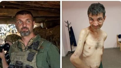 रूस ने दी यूक्रेनी सैनिक को दिल दहला देने वाली यातना.. 4 महीने तक रखा कैद में दुनियाभर में हो रही आलोचना