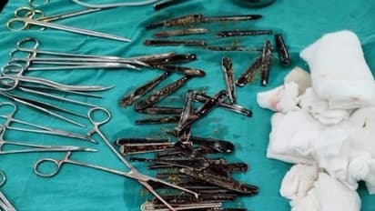 ആരോഗ്യനില വഷളായി ആശുപത്രിയിലെത്തിച്ച യുവാവിന്റെ വയറ്റില് നിന്ന് കണ്ടെത്തിയത്...