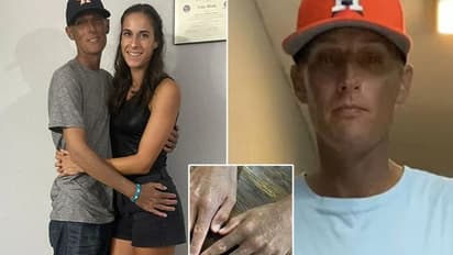 ವ್ಯಕ್ತಿಯ ಬಣ್ಣ ಬದಲಿಸಿದ ಖಿನ್ನತೆಯ ಔಷಧಿ: ಹಾಲಿನಂತಿದ್ದವ ಹಾವಿನಂತಾದ