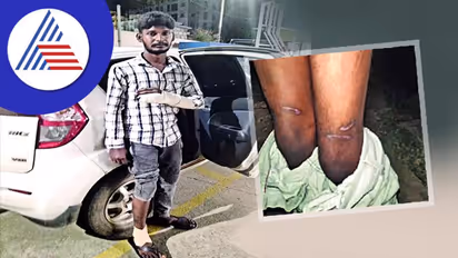 ಬೆಂಗಳೂರು ಠಾಣೆಯಲ್ಲಿ ವ್ಯಕ್ತಿಗೆ ಥರ್ಡ್‌ ಡಿಗ್ರಿ ಟಾರ್ಚರ್‌, ಖಾಸಗಿ ಅಂಗಕ್ಕೆ ವಿದ್ಯುತ್‌ ಶಾಕ್‌ ನೀಡಿದ ಆರೋಪ