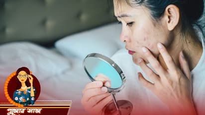 পুজোর আগে ব্রণ দূর করতে মেনে চলুন শেহনাজ হুসেনের টোটকা, জেনে নিন কী কী করবেন