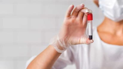 ലക്ഷണങ്ങള്‍ കാണാത്തതിനാല്‍ അറിയാതെ പോകുന്ന നാല് ലൈംഗികരോഗങ്ങള്‍...